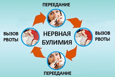 Лечение булимии в Вязниках